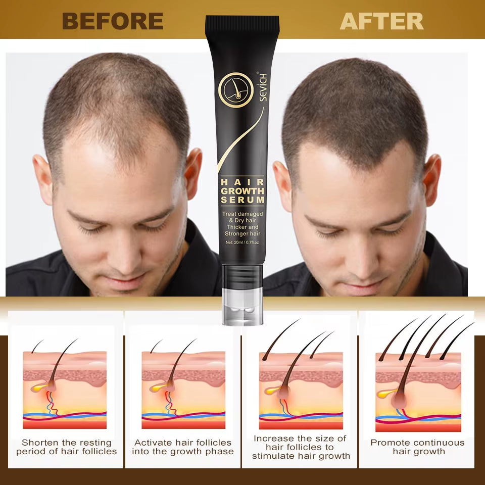 Herbal Fast Hair Growth Oil with Massage Roller 20Ml Hair Loss Treatment Ginger Extract Growing Serum Hair Loss Products